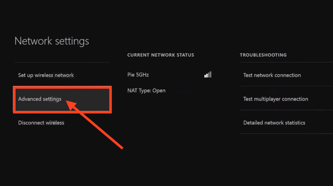 Xbox One OverPlay SmartDNS